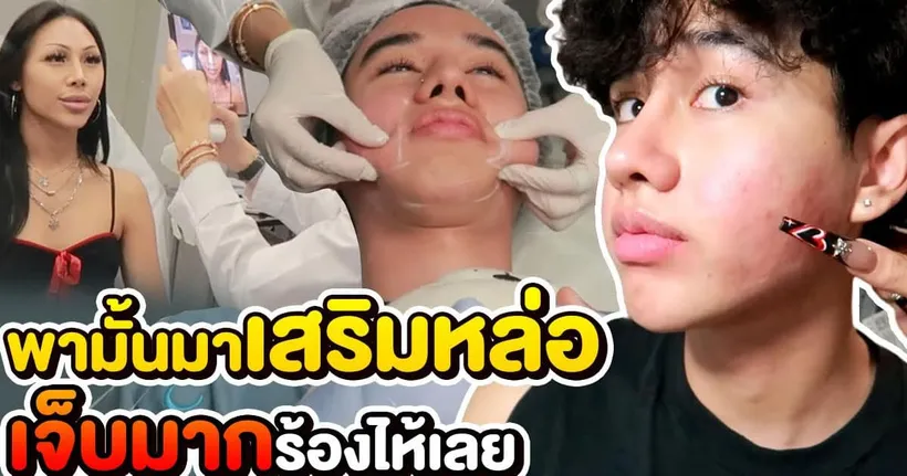 VLOG #218 พามั้นมาเสริมหล่อ !! ใครเหนียงเยอะแก้มเยอะ ต้องดู !!!! ไม่รู้จะหล่อขึ้นไปหาแฟนใหม่ที่ไหน - โลกของคนมีหนวด