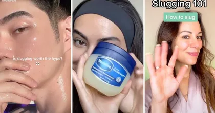 ผู้เชี่ยวชาญเตือน เทรนด์บำรุงผิวหน้าแบบใหม่บน TikTok อาจทำให้เกิดสิวได้ง่าย