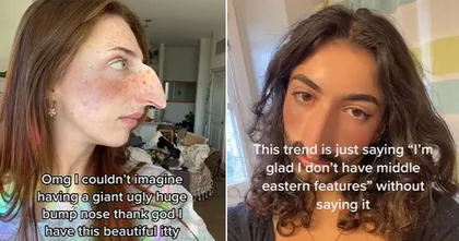 ชาว TikTok ไม่ปลื้มฟิลเตอร์จมูกเหยี่ยว อ้างเป็นการเหยียดเชื้อชาติ
